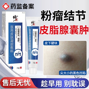 粉瘤皮脂腺囊肿专火疖子疖肿拔毒用皮下囊肿去除神器药监备案膏EM