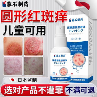 儿童铜钱癣藓体癣真菌感染专用皮肤瘙痒红斑去癣外用药房同款膏YS