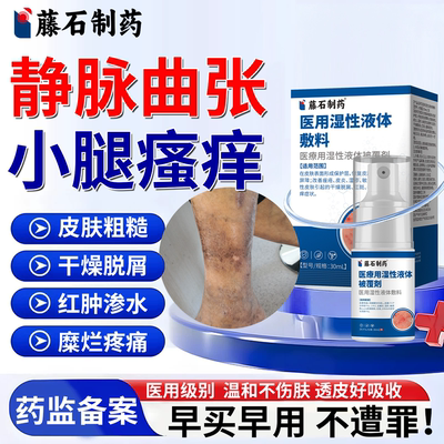 【医用级】静脉曲张性湿疹小腿痒