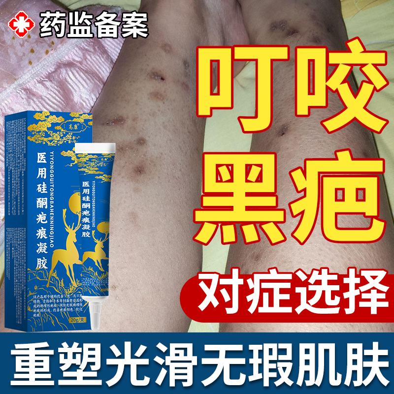 蚊虫叮咬祛疤膏去蚊子咬的疤痕印祛疤印去黑印黑色素沉淀蚊子包YS