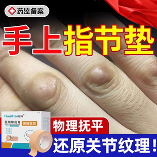 手指关节茧指节垫药房膏手上长硬疙瘩老茧去除去软化根专用胶带YS