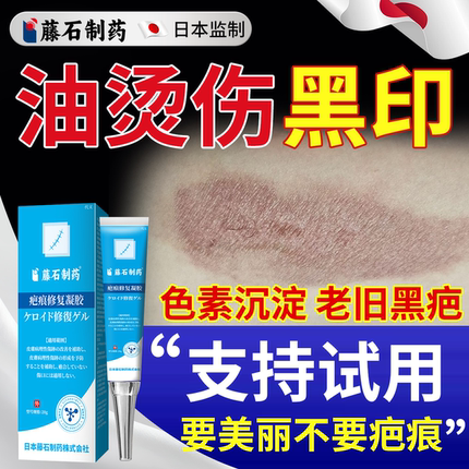 油烫伤去疤膏疤痕修复去黑色素沉淀祛疤除疤膏黑印色素烧伤去除YS