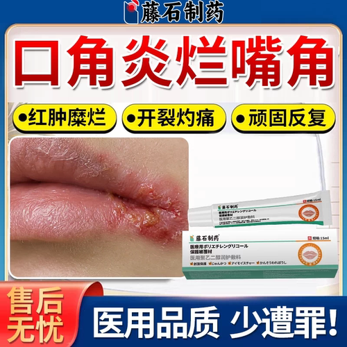 藤石制薬嘴角烂口角炎医用级膏