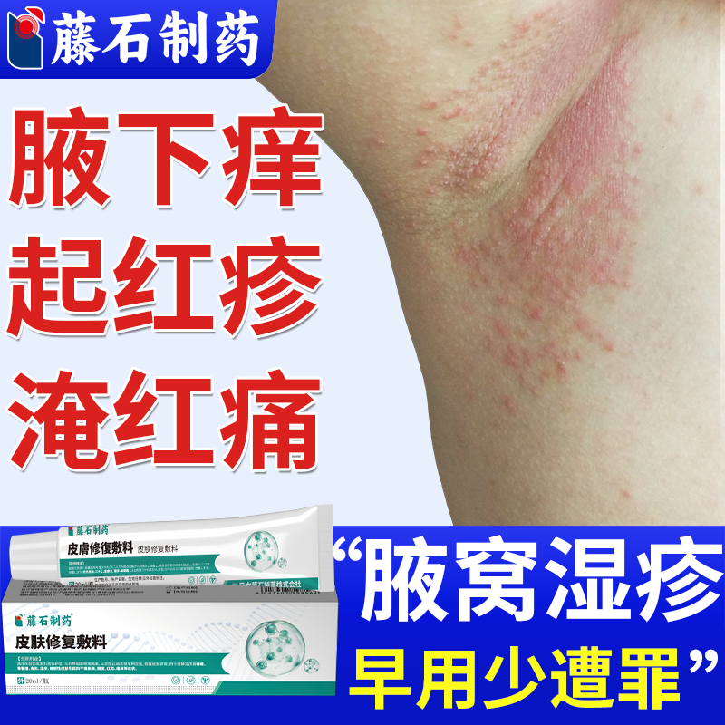 【速发】腋下湿疹胳肢窝淹红瘙痒