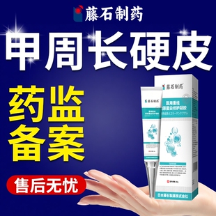 软化甲周硬皮去手指指甲边缘死皮茧子去除专用皮肤变硬软化剂YS