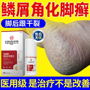 角质型脚气角化型脚癣一次净药房膏足癣专用脚后跟干裂真菌感染YS