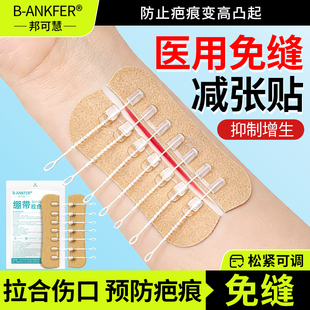 医用皮肤减张贴疤痕减张器伤口刨腹产免缝胶带合拉链创口贴张力贴