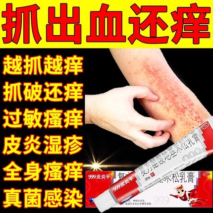 999皮炎平神经性皮炎外用治皮肤瘙痒湿疹止痒药过敏瘙痒症药膏WX