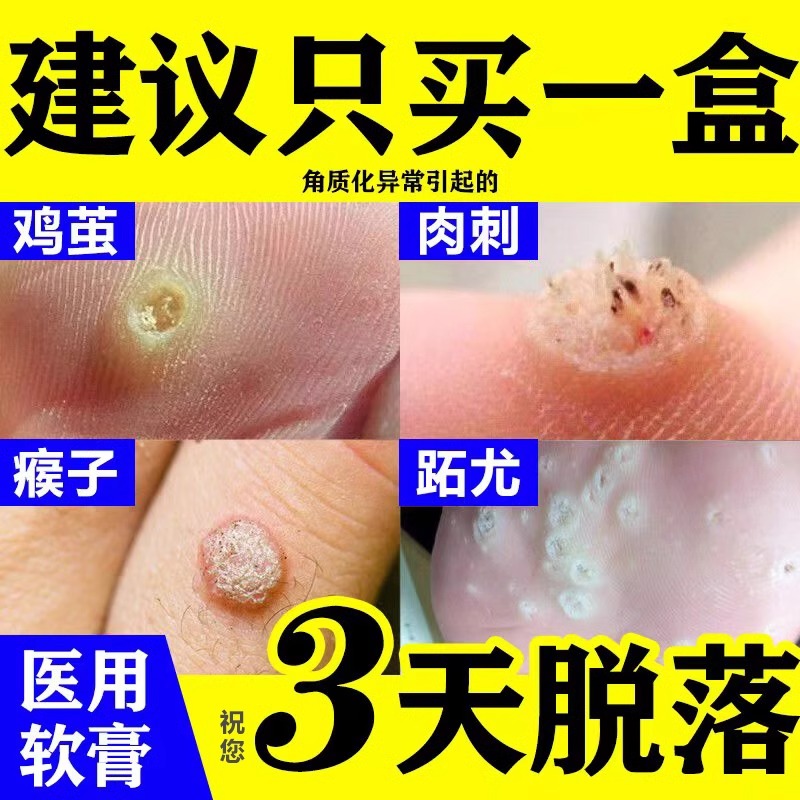 【鑫烨】维A酸乳膏0.1%*10g*1支/盒