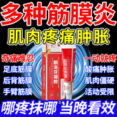 筋膜炎专用特新效期药膏足底脚底后背部手臂肩胛骨颈肩臀疼痛酸胀