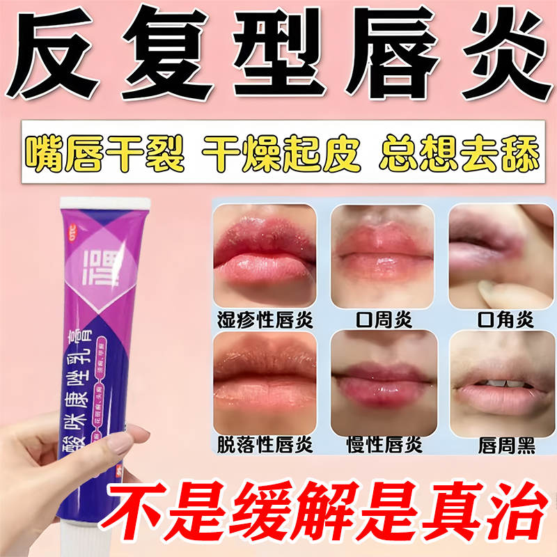 唇炎专用药膏治嘴唇干裂起皮脱皮肿痛结痂烂嘴角硝酸咪康唑乳膏
