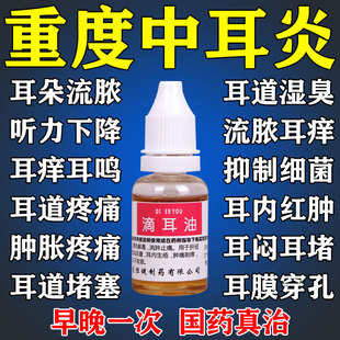 中耳炎专用特痒效药可除耳根滴耳液耳朵痒耳朵流脓流水滴耳油