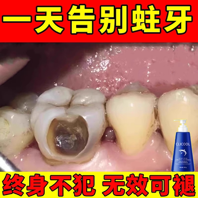 防蛀牙龋齿修复儿童牙膏防蛀牙无氟按压式换牙期宝宝旗舰店益生菌
