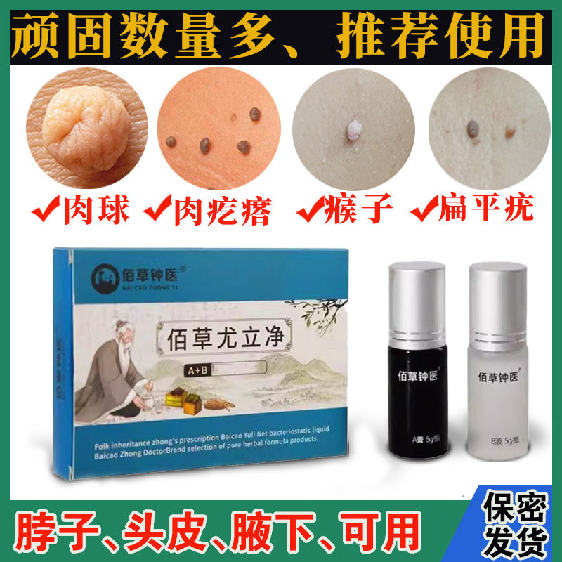 扁平疣去除膏一抹灵点面部扁平疣去疣猴小肉粒疙瘩丝状疣去疣去痣