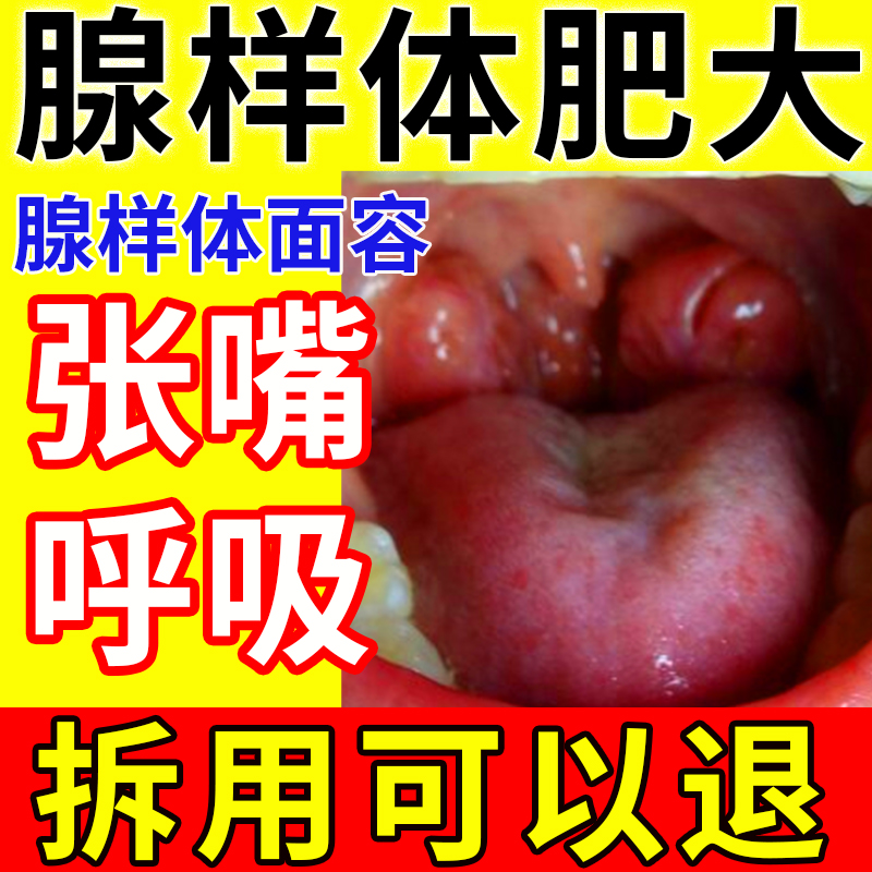 腺样体肥大中药贴调理面容矫正器儿童鼻炎鼻塞睡觉张嘴呼吸贴神器