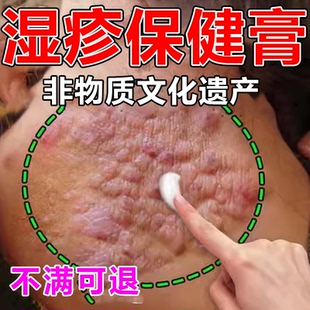 湿疹保健膏神经性皮炎瘙痒膏脂溢性湿疹止痒外用顽固溢脂性软膏