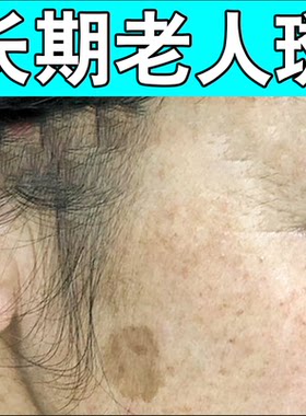 老人斑专用膏除老年黑色素脸部黄褐斑雀斑点除斑