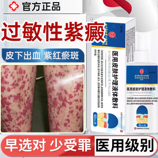 色素过敏性紫癜疗皮下出血红点瘀紫癜性皮炎出血管炎可搭膏药贴MR