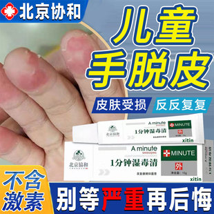 儿童手指脱皮手指尖起皮专用膏真菌感染干裂严重蜕皮剥脱性干燥GX