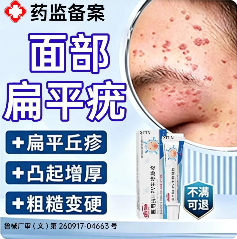 医用祛疣瘊丝状疣扁平疣去小肉粒去除膏一抹灵面颈部专用膏hpvUU