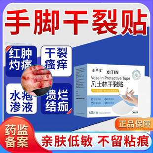 凡士林冻疮膏贴医用手足干裂贴防冻伤儿童脸耳朵止痒官方旗舰店ZT