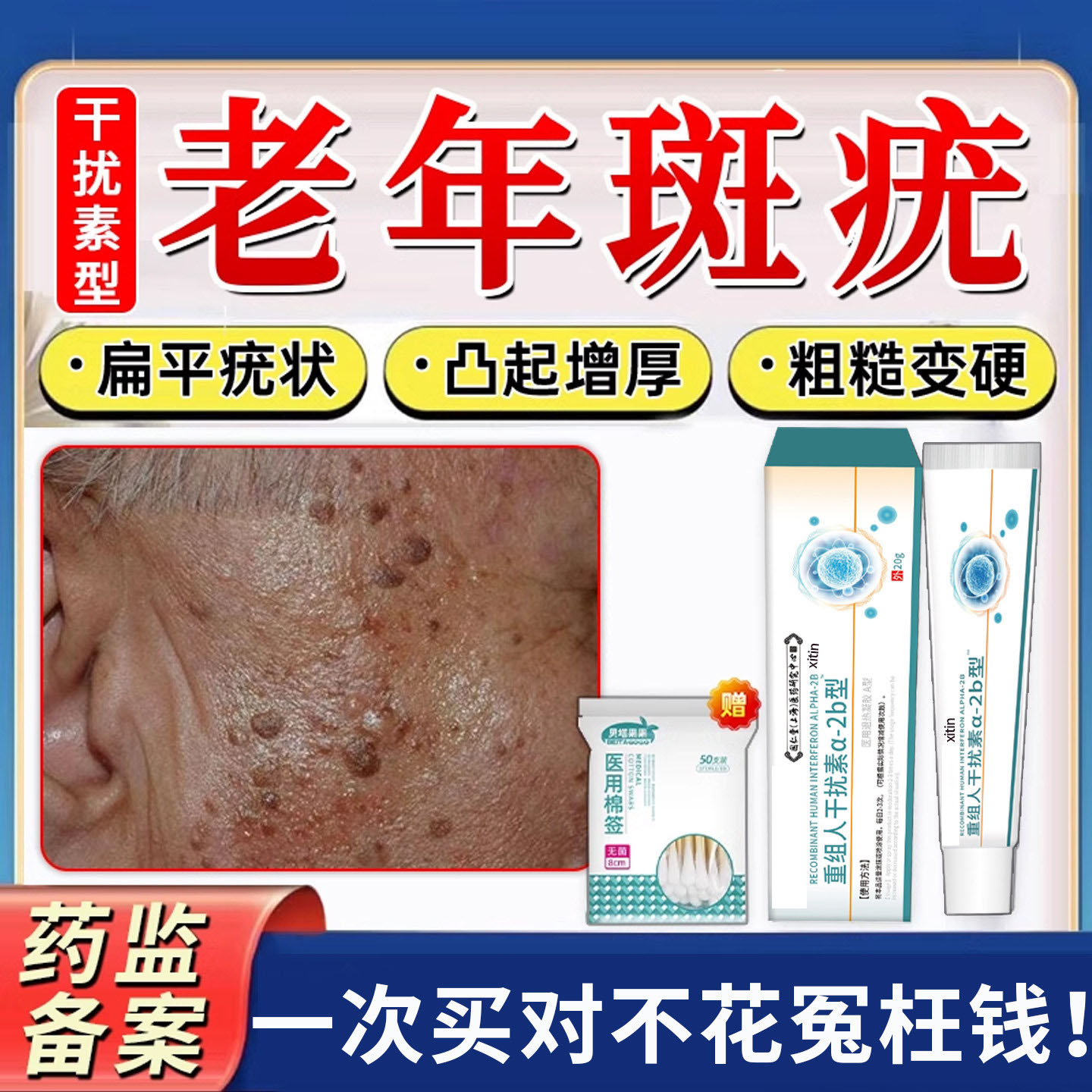 脸上扁平疣专用老年斑增厚凸起肉粒疙瘩老人疣一抹灵黑斑去除膏TT