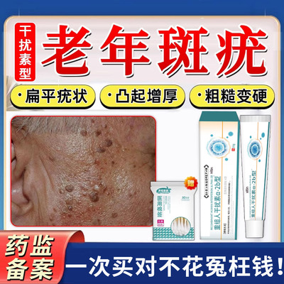脸上扁平疣专用老年斑增厚凸起肉粒疙瘩老人疣一抹灵黑斑去除膏TT