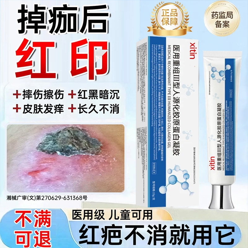 摔伤擦伤结痂掉痂后留红印疤痕修复凝胶去红黑印淡化止痒除疤膏UU图片