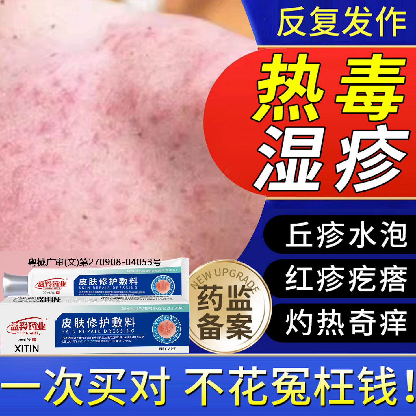 热毒湿疹止痒膏血热皮肤痒癣除湿专用水泡去顽固皮炎真菌感染TT