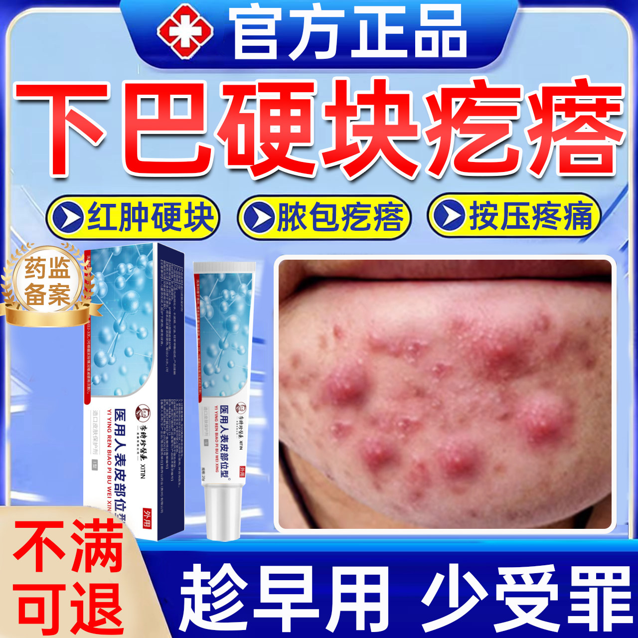 下巴反复长痘硬块修复膏内分泌失调痘痘红肿疼结节脓包痤疮囊肿UU