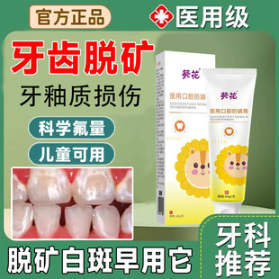 牙齿脱矿专用牙膏牙釉质修复涂氟漱口水儿童再矿化白斑钙化补矿GX