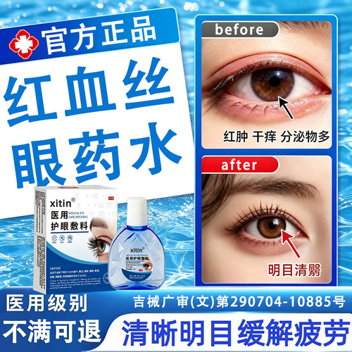 滴眼液缓解眼疲劳干眼涩视力模糊不清熬夜玩手机去红血丝眼药水JN