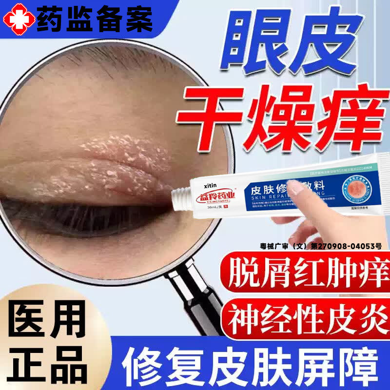 眼皮癣神经性皮炎眼睛周围眼角痒癣干燥起皮过敏疼痛痘红肿掉屑LT