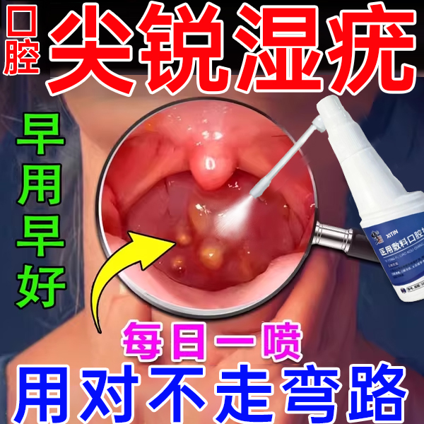 口腔尖锐湿疣喷雾