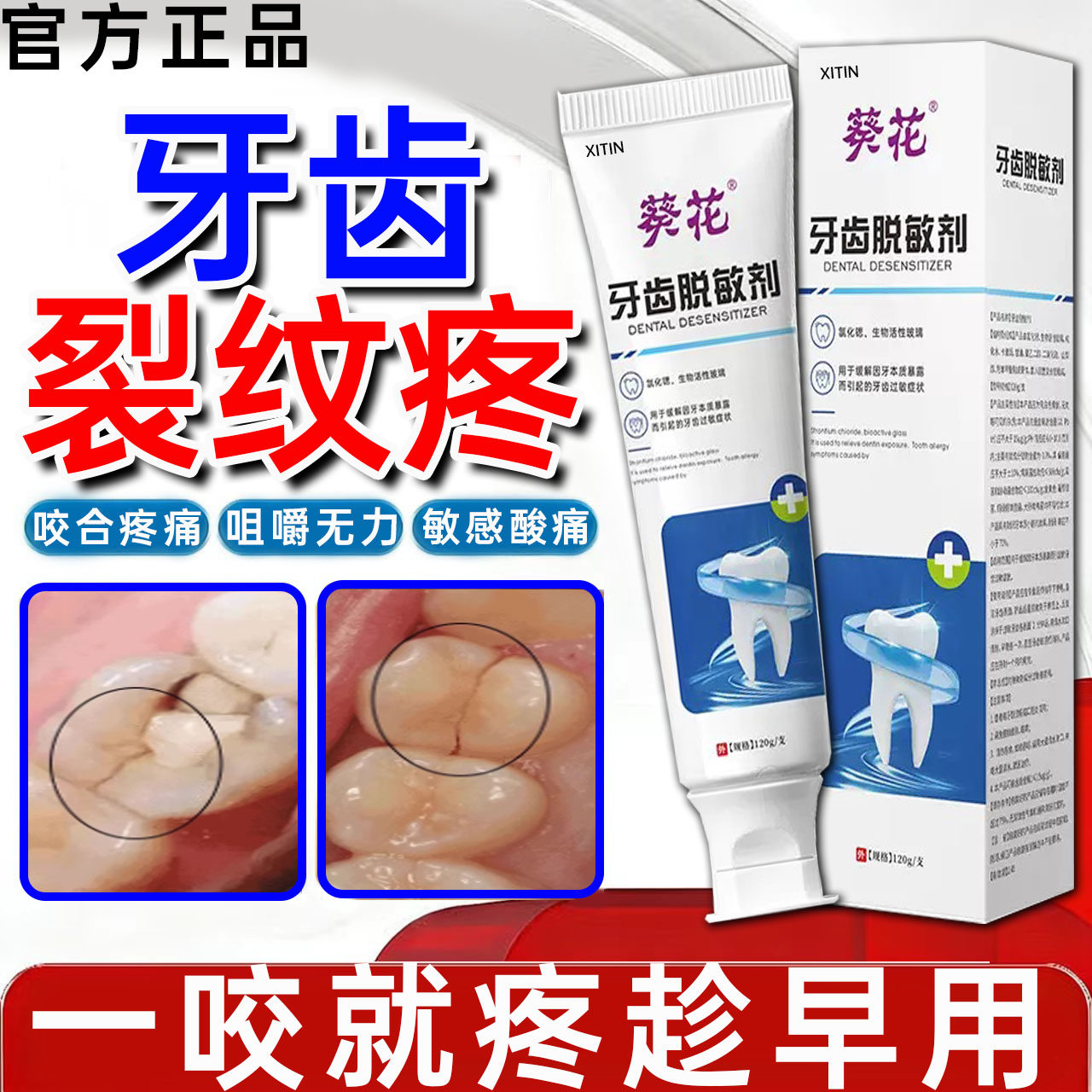 牙齿裂纹修复液牙釉质损伤牙隐裂牙齿裂缝咬合疼痛无力敏感牙膏WY,医疗器械,牙齿防龋/脱敏类,淘宝优惠券,粉丝福利购,淘宝优惠卷