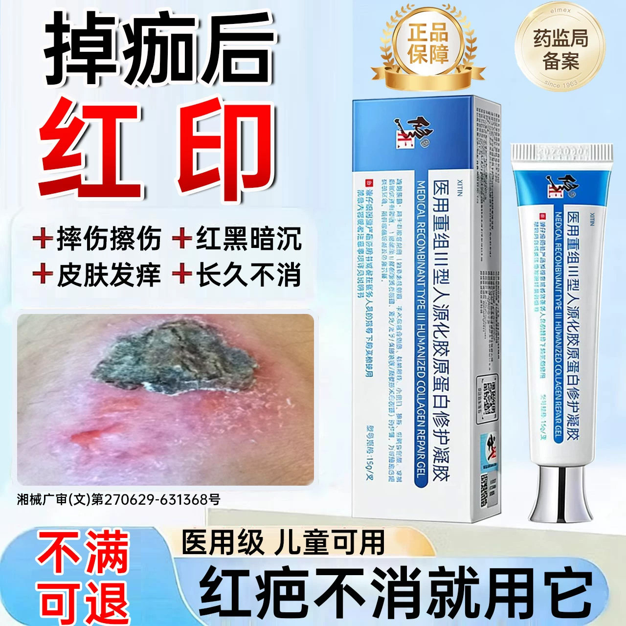 摔伤擦伤结痂掉痂后留红印疤痕修复凝胶去红黑印淡化止痒除疤膏UU