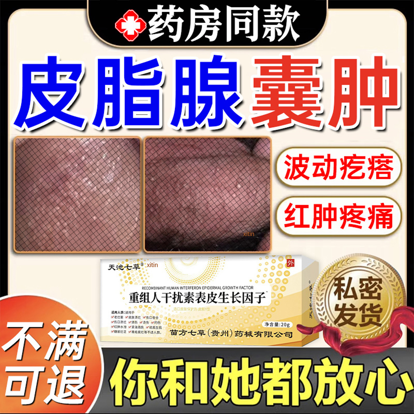私处皮脂腺囊肿专用药膏粉瘤阴茎囊疼痛瘙痒长脂肪小颗粒增生男TT