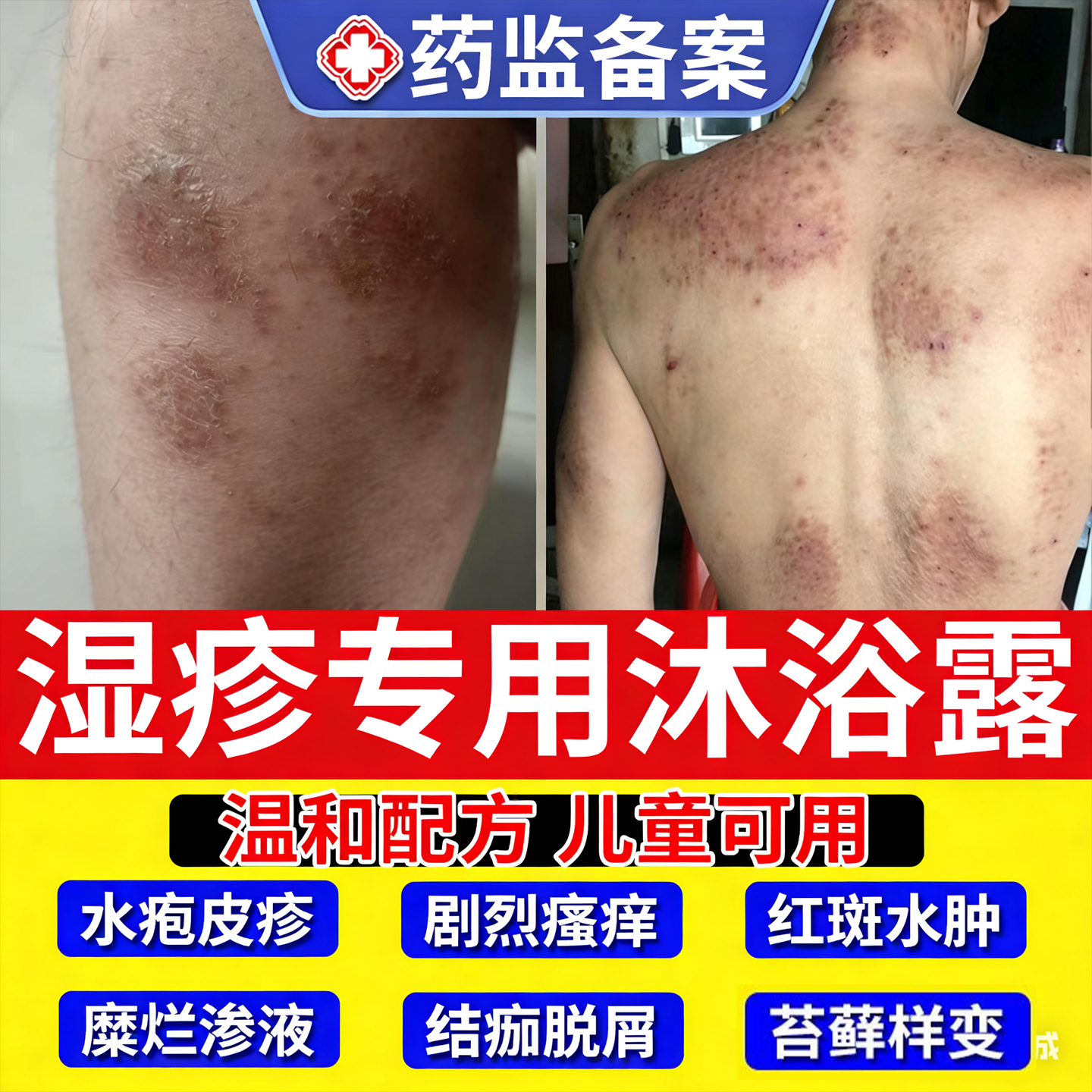 皮肤湿疹顽固皮炎真菌感染皮疹止痒去洗剂液根泡澡包专用沐浴露TT