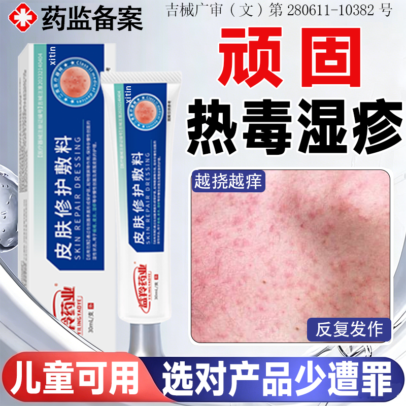 热毒湿疹止痒膏皮肤一热就痒去清根外用顽固皮炎瘙痒抗菌消炎专WK
