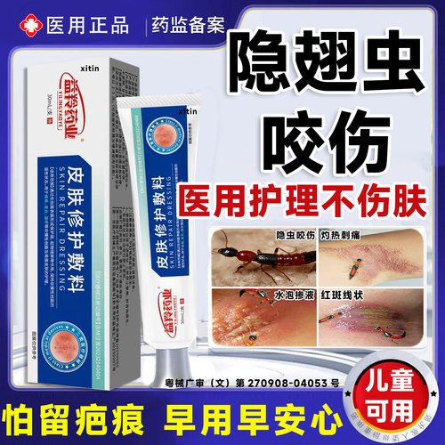 隐翅虫咬伤药膏专医用克星祛疤痕修复黑红印蚊虫咬疼痛儿童可用LT