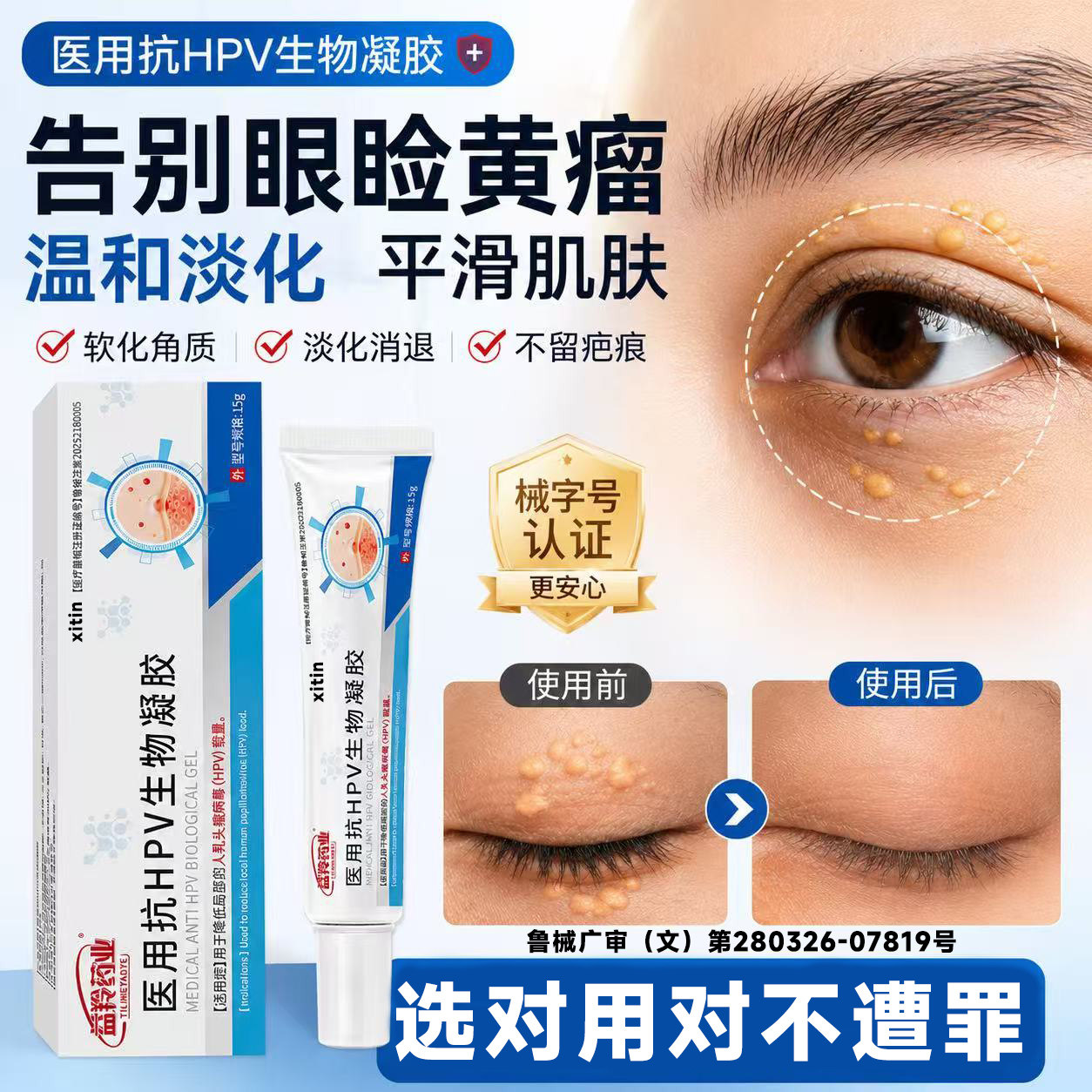 眼睑黄瘤去除眼皮黄斑瘤用专膏脂肪粒神器睑疣皮血脂高药监备案LT