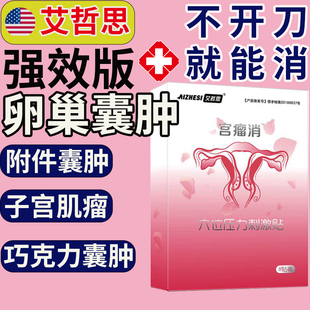 治疗卵巢囊肿的药中药贴巧克力囊肿治疗特效调理去除附件泡脚包LL
