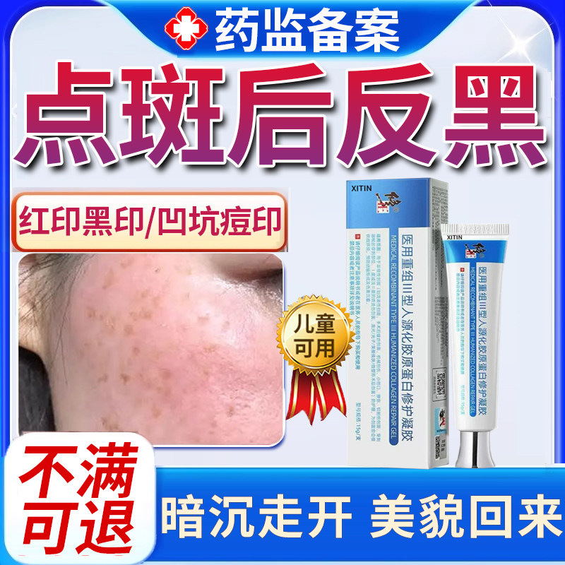 点斑后反黑祛痣激光祛斑痣去红印黑印退淡印消印疤痕膏脸部专用PP