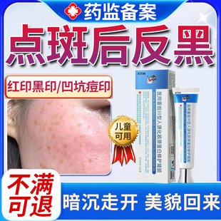 点斑后反黑祛痣激光祛斑术后点痣后去红印黑印退红淡印消印疤痕MR