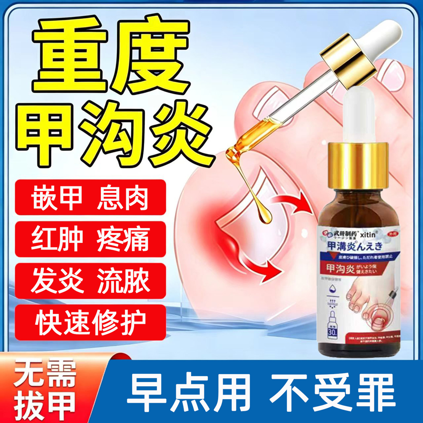 甲沟炎治疗专用特效甲沟炎息肉去除药膏脚趾甲增厚变黄甲沟炎ZY
