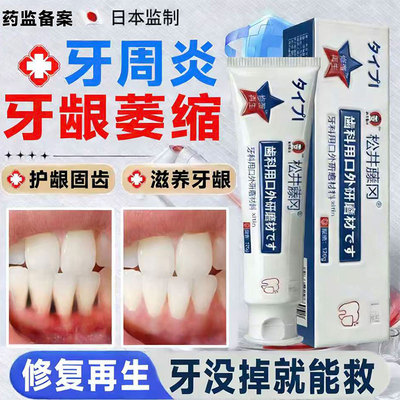 牙龈萎缩修复再专生用牙护膏龈固齿官方旗舰店牙周炎口腔重度治GX