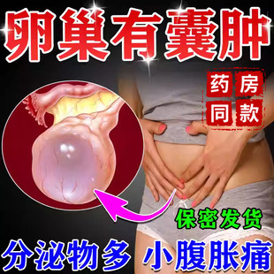 卵巢囊肿调理中药贴宫颈巧克力囊肿穴位贴子宫肌瘤肿块怎么消除ZT