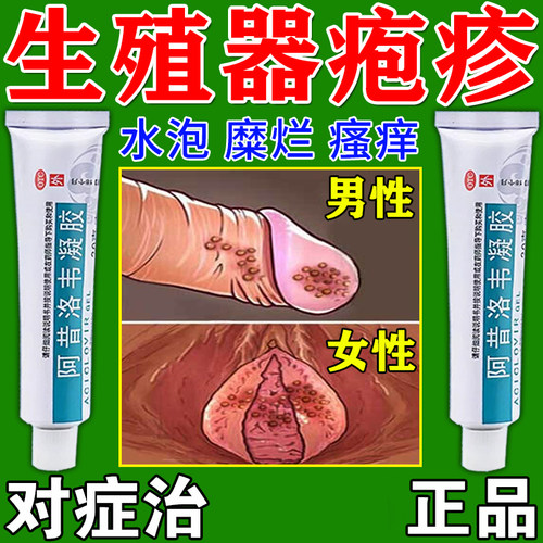 阿昔洛韦凝胶官方旗舰店生殖器疱疹专用药成人皮肤真菌感染消炎膏