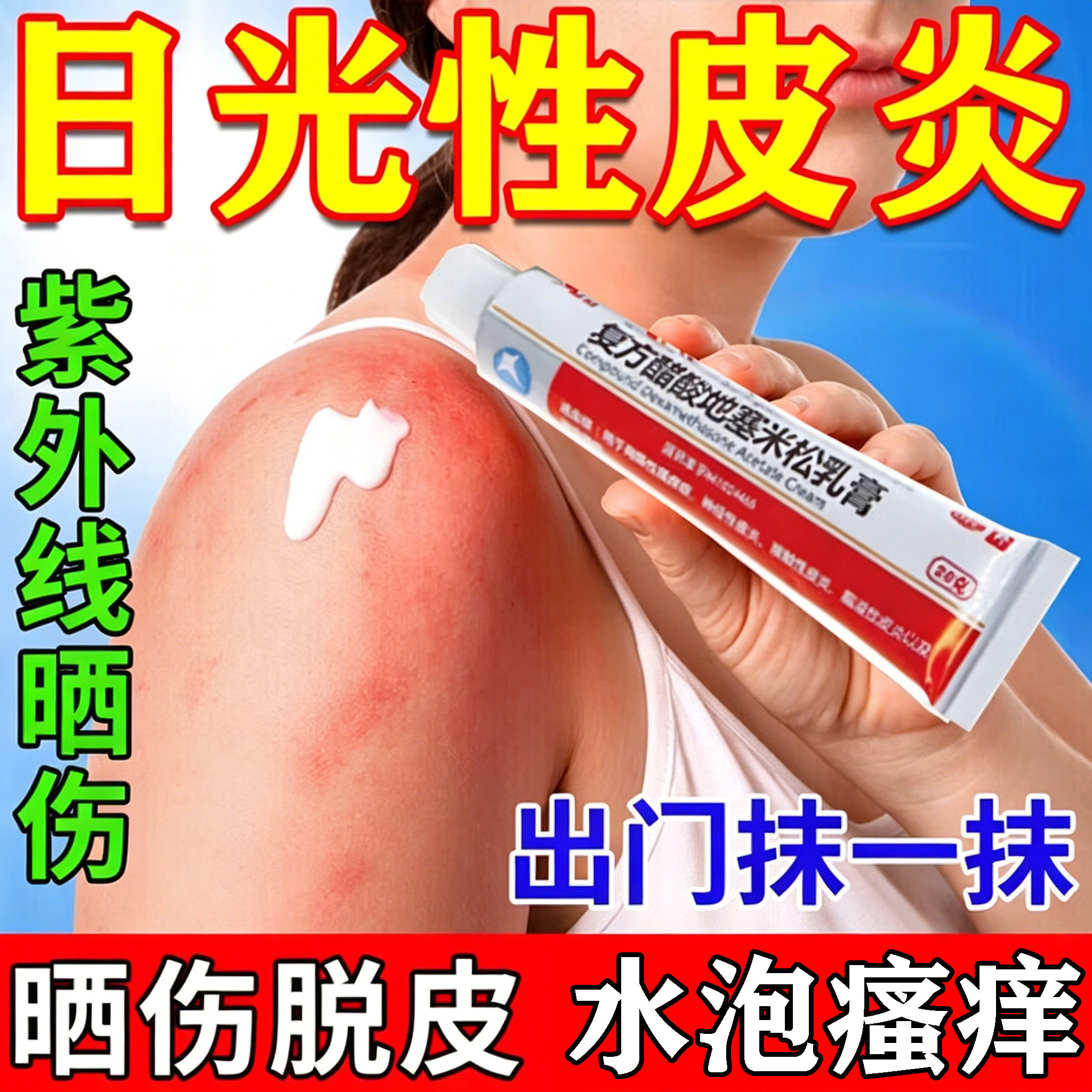 日光性皮炎太阳晒伤紫外线过敏修抗菌消炎