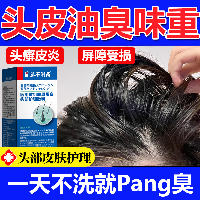 头发皮出汗油臭异味脂溢性皮炎头癣屑毛囊炎痘痘止痒马拉色菌wg